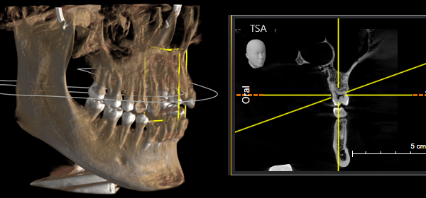 3d-Röntegnbild vom Kopf